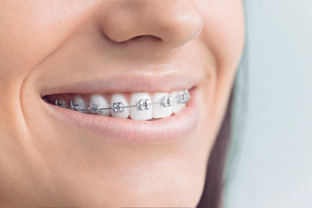 Best Full Mouth Reconstruction  in Pottstown, PA